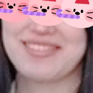 口コミ