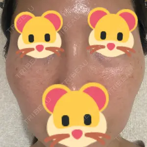 ルラ美容クリニック ルラ美容クリニック 大宮院 / ルラスキンクリニック 大宮院口コミ