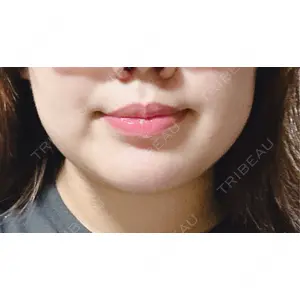 R Beauty CLINIC R Beauty CLINIC 名古屋院口コミ