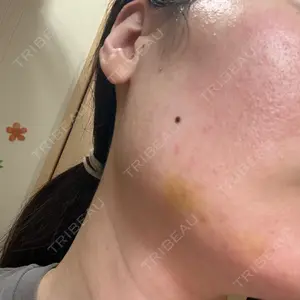ルラ美容クリニック ルラ美容クリニック 新宿院口コミ