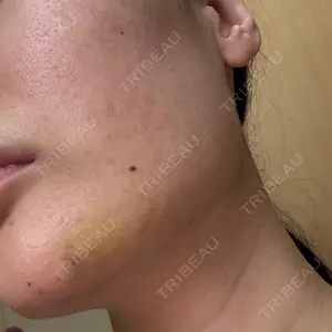 ルラ美容クリニック ルラ美容クリニック 新宿院口コミ