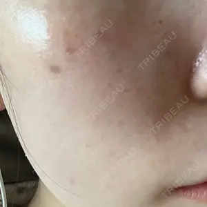 MIO CLINIC 梅田院口コミ