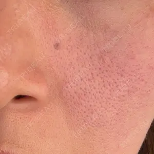 おおかみ美容のクリニック おおかみ美容のクリニック 新宿院口コミ