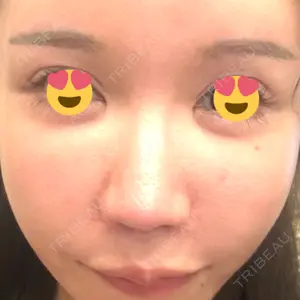 口コミ