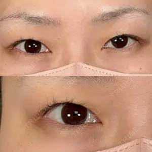 アリエル美容クリニック アリエル美容クリニック 大宮院口コミ