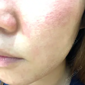 LA CLEF CLINIC（ラクレクリニック）口コミ