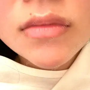 HAAB CLINIC HAAB×DREAM BEAUTY CLINIC 大阪梅田院口コミ