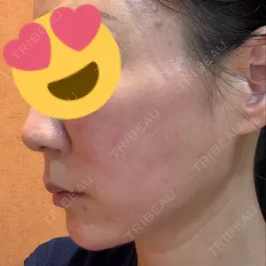 LA CLEF CLINIC（ラクレクリニック）口コミ