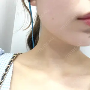 口コミ