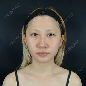 藤・ナチュレ美容クリニック 藤・ナチュレ美容クリニック 銀座院口コミ