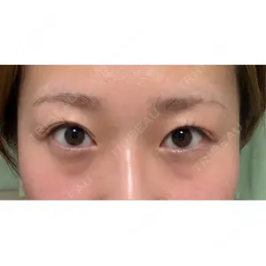 セオリークリニック口コミ