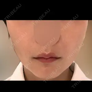 AZ BEAUTY CLINIC口コミ