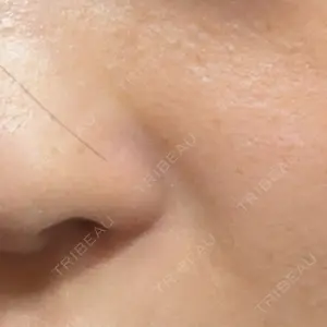 HAAB CLINIC HAAB BEAUTY CLINIC 名古屋院口コミ