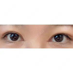 HAAB CLINIC HAAB BEAUTY CLINIC 名古屋院口コミ