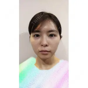 ボンディ美容整形外科（旧リオン整形外科）口コミ