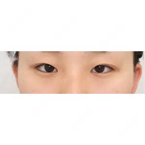 口コミ