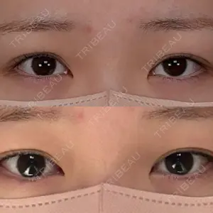 アリエル美容クリニック アリエル美容クリニック 大宮院口コミ