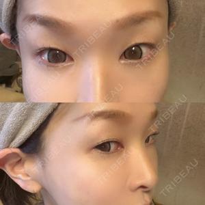 ルラ美容クリニック ルラ美容クリニック 横浜院口コミ