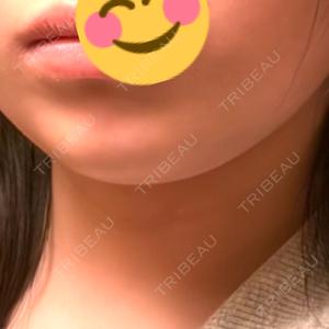 ルラ美容クリニック ルラ美容クリニック 札幌大通り院口コミ