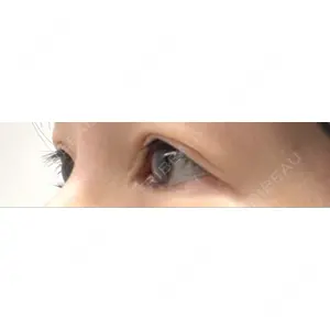 BIANCA CLINIC BIANCA銀座口コミ