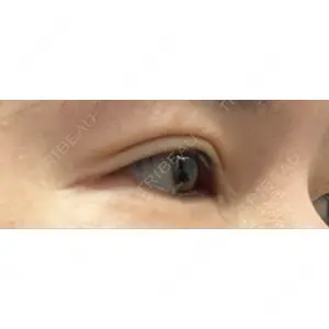 BIANCA CLINIC BIANCA銀座口コミ