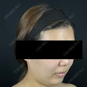 藤・ナチュレ美容クリニック 藤・ナチュレ美容クリニック 銀座院口コミ