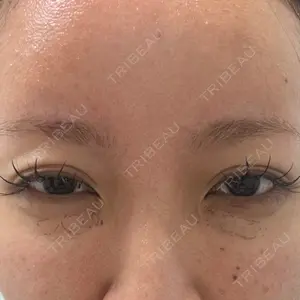 東京形成美容外科 東京形成美容外科 船橋院口コミ