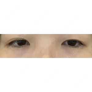 オアシス美容外科口コミ