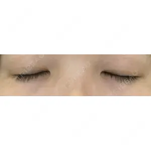 オアシス美容外科口コミ