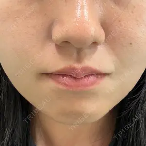 ルラ美容クリニック ルラ美容クリニック 新宿院口コミ
