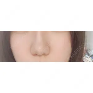 東京形成美容外科 東京形成美容外科 船橋院口コミ