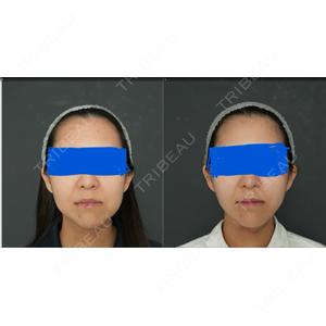 Lipo Clinic omotesandoの