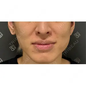 EMMO FACE CLINIC EMMO FACE CLINIC 東京三田院口コミ