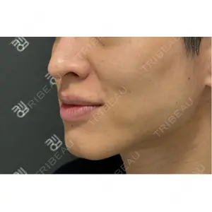 EMMO FACE CLINIC EMMO FACE CLINIC 東京三田院口コミ