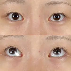 藤・ナチュレ美容クリニック 藤・ナチュレ美容クリニック 銀座院口コミ
