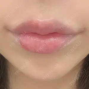 口コミ