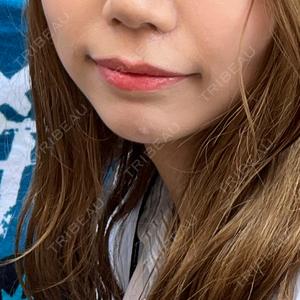 口コミ