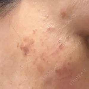 ルラ美容クリニック ルラライト美容クリニック 八王子院口コミ