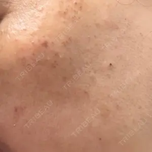 ルラ美容クリニック ルラライト美容クリニック 八王子院口コミ