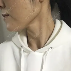 有楽町高野美容クリニック口コミ