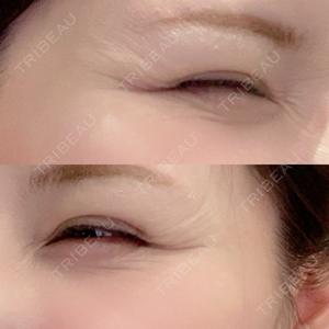 プロクリニック PRO CLINIC プロクリニック 銀座院口コミ