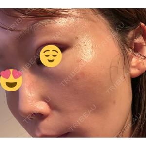 ビラビューティークリニック 博多美容外科/美容皮膚科 ビラビューティークリニック口コミ