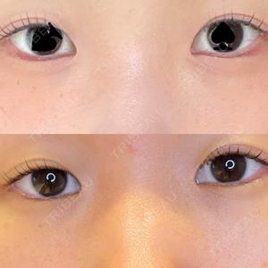 LOUIS CLINIC 二子玉川院【ルイクリニック】口コミ