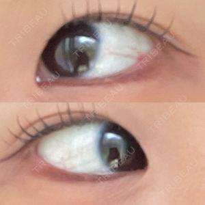 LOUIS CLINIC 二子玉川院【ルイクリニック】口コミ