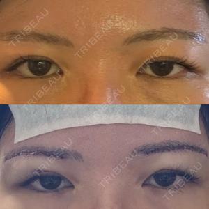 もとび美容外科クリニック 新宿院口コミ