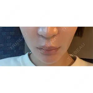 ハナビューティークリニック口コミ