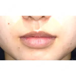 B-LINE CLINIC B-LINE CLINIC 池袋院口コミ