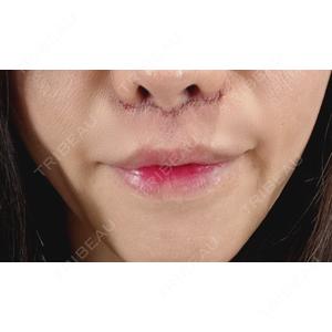 PRISM Beauty Clinic  PRISM Beauty Clinic 町田院口コミ