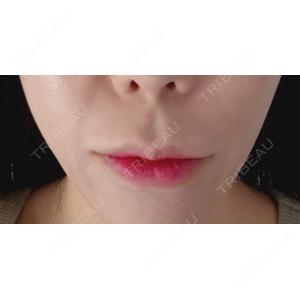 PRISM Beauty Clinic  PRISM Beauty Clinic 町田院口コミ