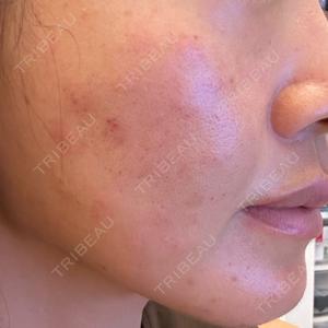 Natural Skin Clinic Natural Skin Clinic 自由ヶ丘院口コミ